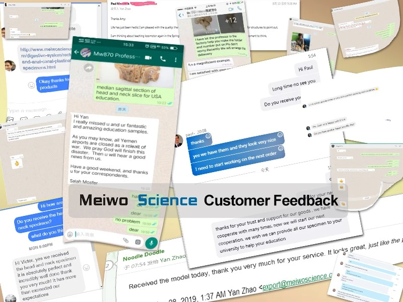 meiwo silicone models customer feedback meiwo silicone models customer feedback